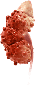 Sick kidney image